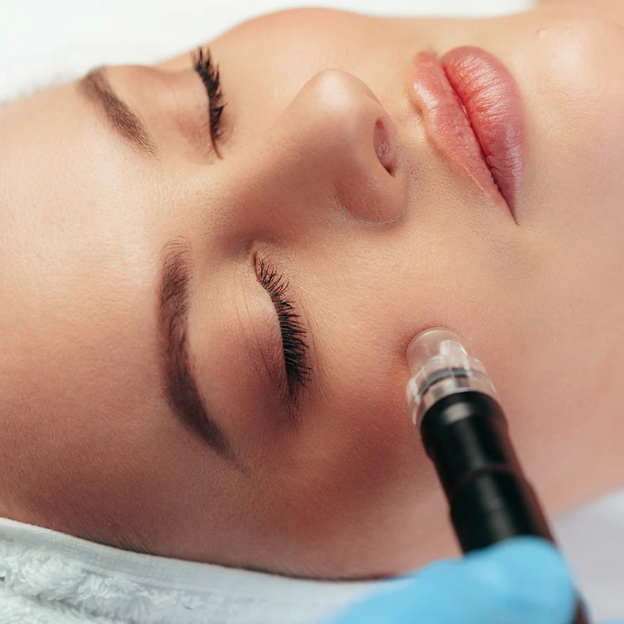 Unveiling the Benefits of Microneedling: What Does it Do for You? - A South African Perspective with Deluxe Shop