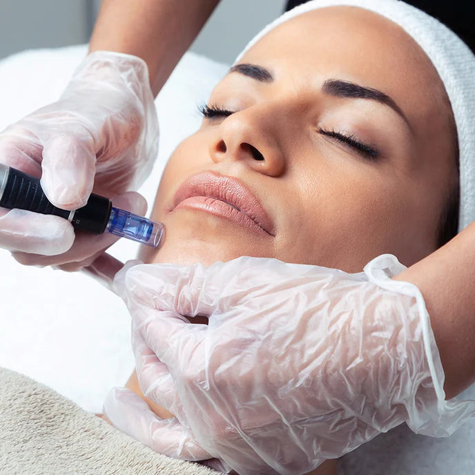 What Does Microneedling Actually Do? Benefits, Results & Tools at Deluxe Shop South Africa